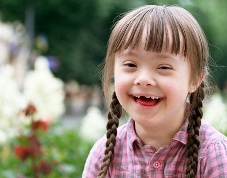 Menina com síndrome de down sorrindo